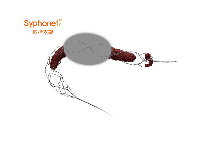 Syphonet®取栓支架