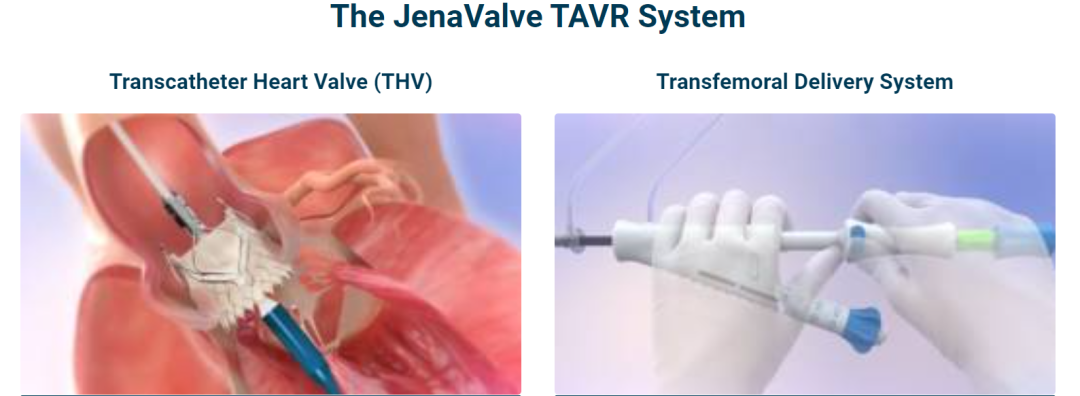 沛嘉医疗License In创新产品完成美国ALIGN-AR注册临床入组，期待早日惠及中国患者