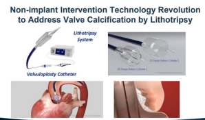 SmartWave LITHOTRIPSY VALVULOPLASTY TECHNOLOGY SHOWCASED AT TCT2024