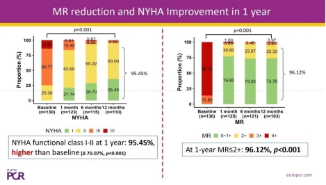 EuroPCR 2025 One-Year Follow-Up Results from Pivotal Trial of GeminiOne® TEER System Released
