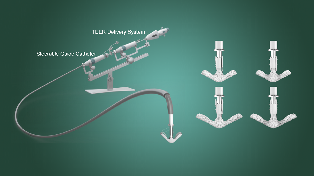 SUBMISSION OF EU MDR CE MARK REGISTRATION FOR THEGeminiOne® TRANSCATHETER EDGE-TO-EDGE REPAIR SYSTEM